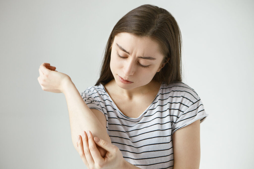 Urticaria Treatment