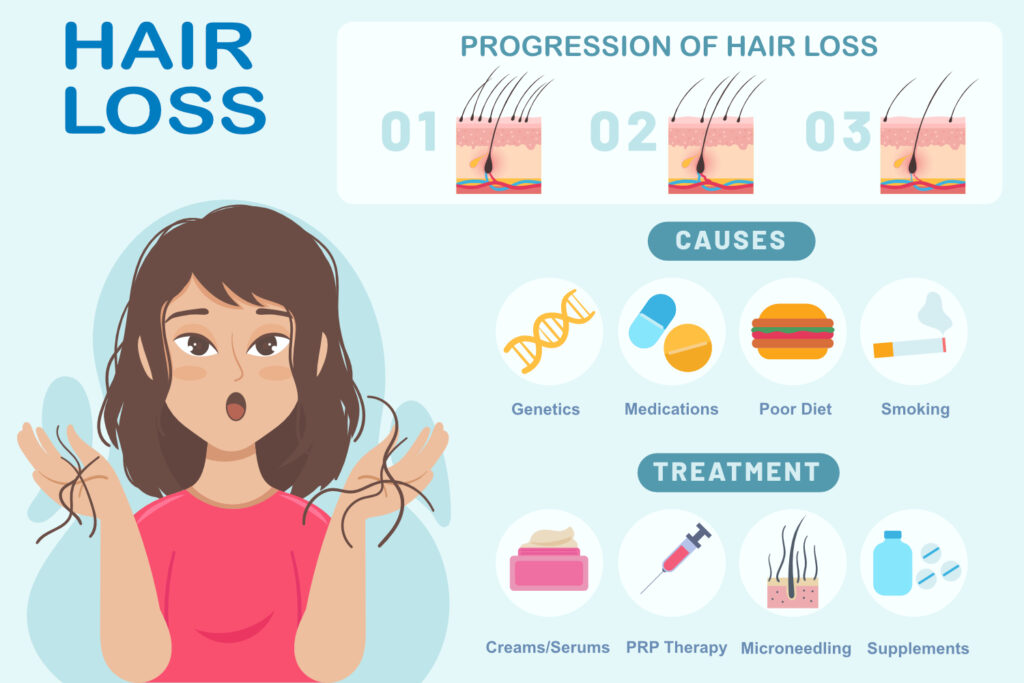 Hair Loss in Females