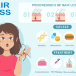 Hair Loss in Females